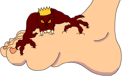 Bệnh gout là gì?