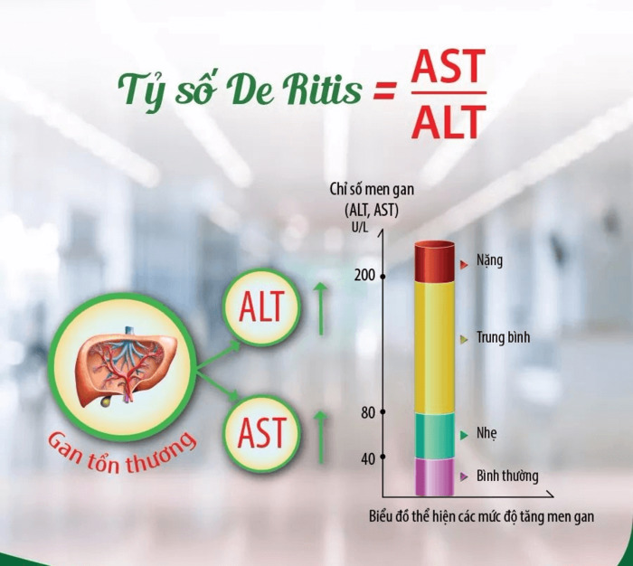 Chỉ số ALT, AST đánh giá tình trạng và mức độ tổn thương gan của bạn