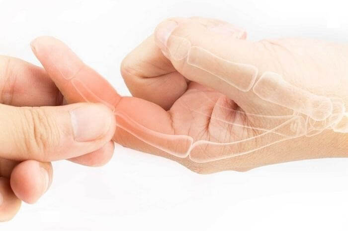 Cứng khớp ngón tay là bệnh lý không nên chủ quan
