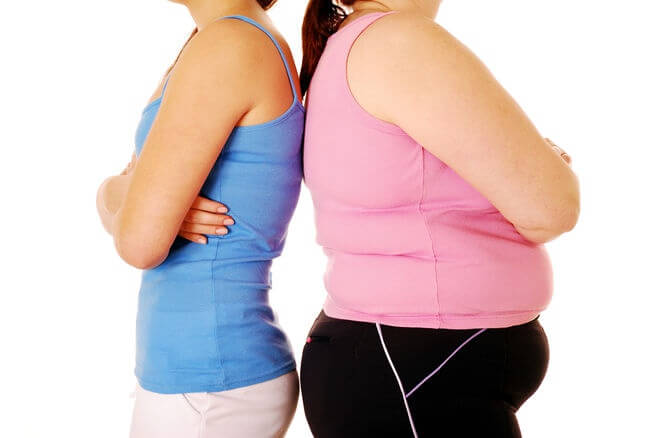 Người béo phì dễ mắc bệnh thoái hóa khớp gối