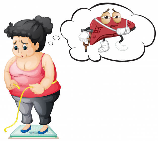 Người thừa cân, béo phì cũng là nguyên nhân gây nên tình trạng tăng men gan