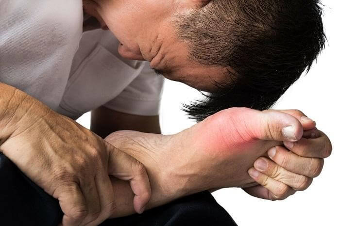 Bệnh gout gây ra những cơn đau nhức khủng khiếp, khiến sức khỏe người bệnh bị tổn hại