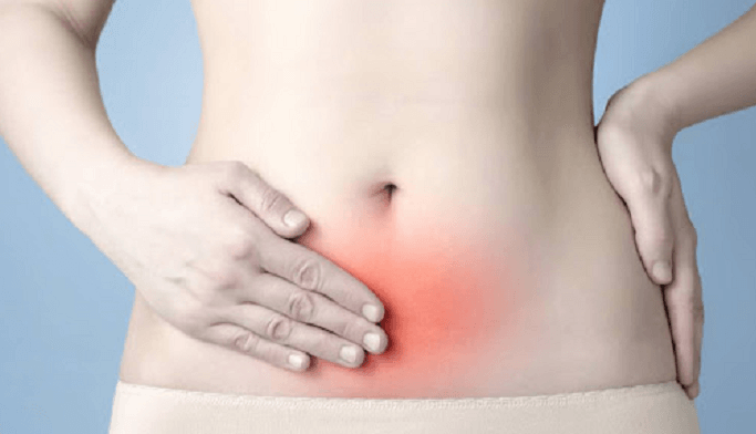 Đau vùng bụng dưới – dấu hiệu của u nang buồng trứng