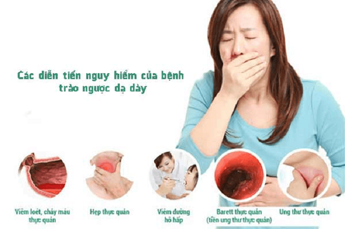 Các biến chứng nguy hiểm của bệnh