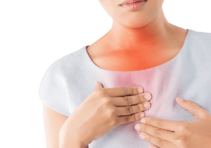 Ợ nóng chính là một biểu hiện của bệnh trào ngược dạ dày thực quản