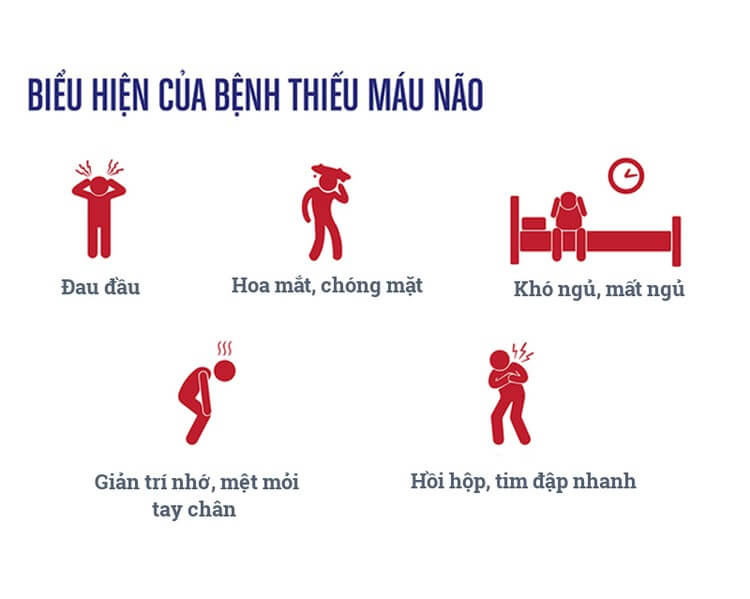 Các triệu chứng, biểu hiện thường gặp của bệnh thiếu máu não