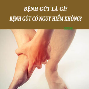 Bệnh gout có nguy hiểm không?