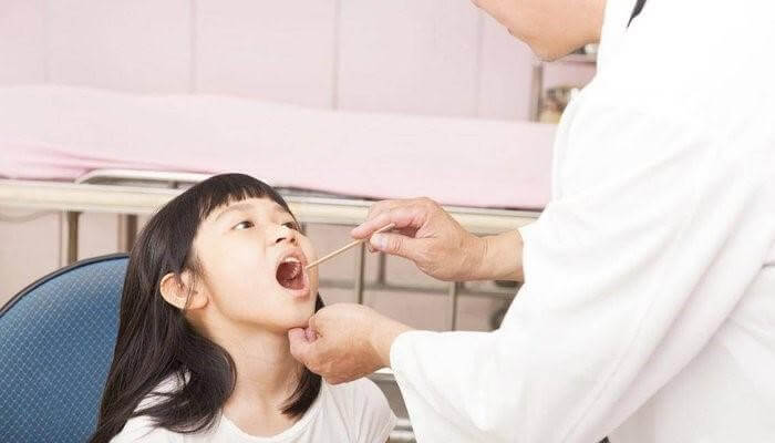 Bệnh viêm họng xảy ra nhiều ở trẻ em và thanh thiếu niên