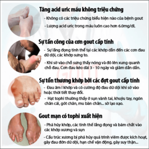 Các triệu chứng qua từng giai đoạn của bệnh Gout