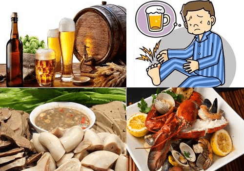 Một số nguyên nhân gây ra bệnh Gout