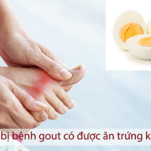 Người bị bệnh gout có ăn được trứng không?