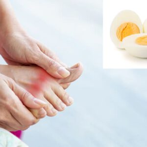 Người mắc bệnh gout hoàn toàn có thể sử dụng trứng