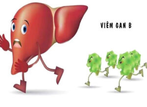 Bệnh viêm gan b do virus HBV gây nên