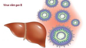 Bệnh virus viêm gan B ngày càng phổ biến