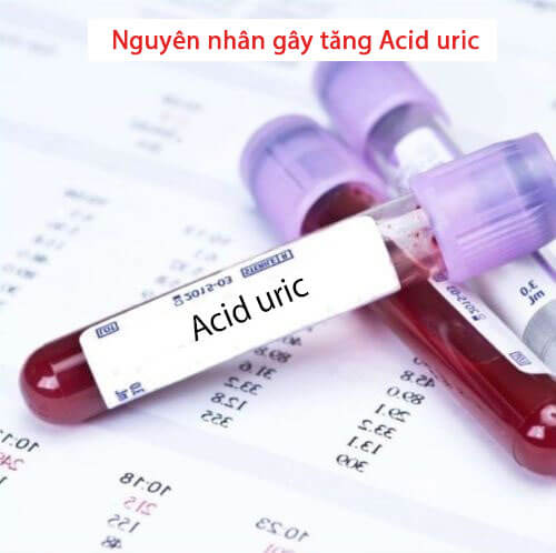 Nguyên nhân gây nên tình trạng acid uric tăng và cách điều trị phòng ngừa bệnh hiệu quả