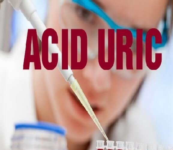 Người bị bệnh gout nên đi xét nghiệm acid uric máu thường xuyên