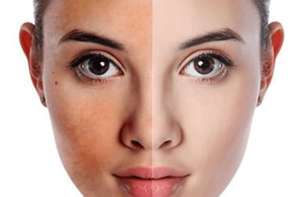 Dưỡng trắng da mặt là một trong những vấn đề hàng đầu của phái đẹp