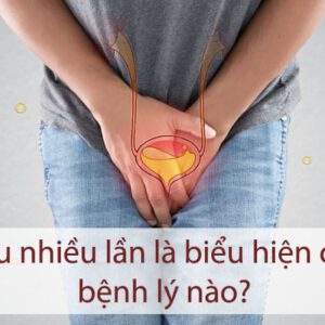 Tiểu nhiều lần là biểu hiện của bệnh lý nào?