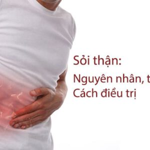 Sỏi thận: Nguyên nhân, triệu chứng và cách điều trị bệnh