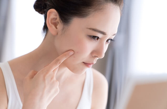 cách chăm sóc da mặt bị mụn
