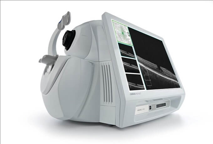Chụp cắt lớp kết hợp quang học (OCT) là một cách hiệu quả để chẩn đoán AMD