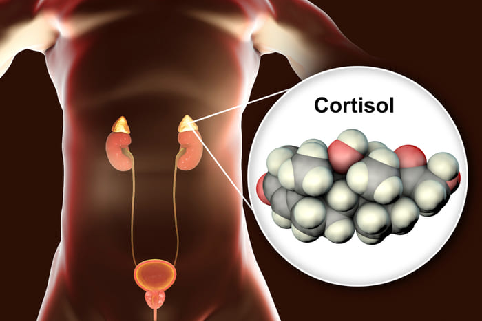 Suy tuyến thượng thận làm giảm tiết cortisol